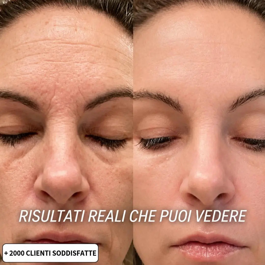 PDRN Active Stick | Siero Solido Biorivitalizzante Antirughe